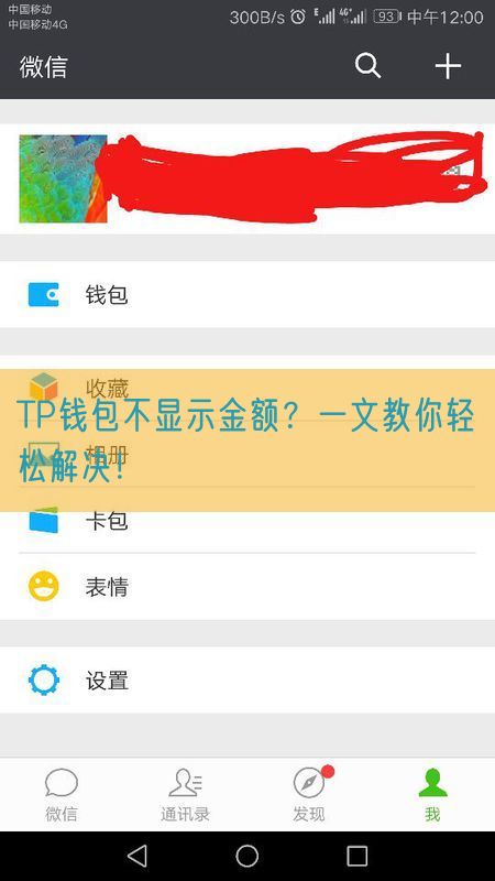 TP钱包不显示金额？一文教你轻松解决！